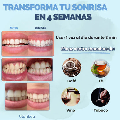 Blankea Dental Pro™ –  Nova God Tech